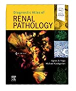 Diagnostic Atlas of Renal Pathology Book Cover