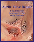 Aortic Valve Repair Book Cover
